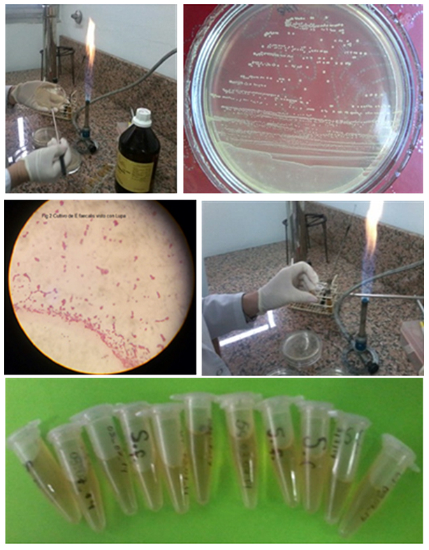 Figura 6: a. Reactivación de la cepa de E. faecalis en BHI. b. Cultivo de E. faecalis en BHI. c. Observación del cultivo de E. faecalis con lupa. d. Siembra de E. faecalis en glicerol. e. Almacenamiento en glicerol de las cepas de E. faecalis.