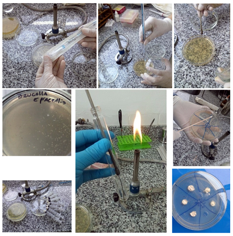 Figura 7: Técnica de difusión en agar