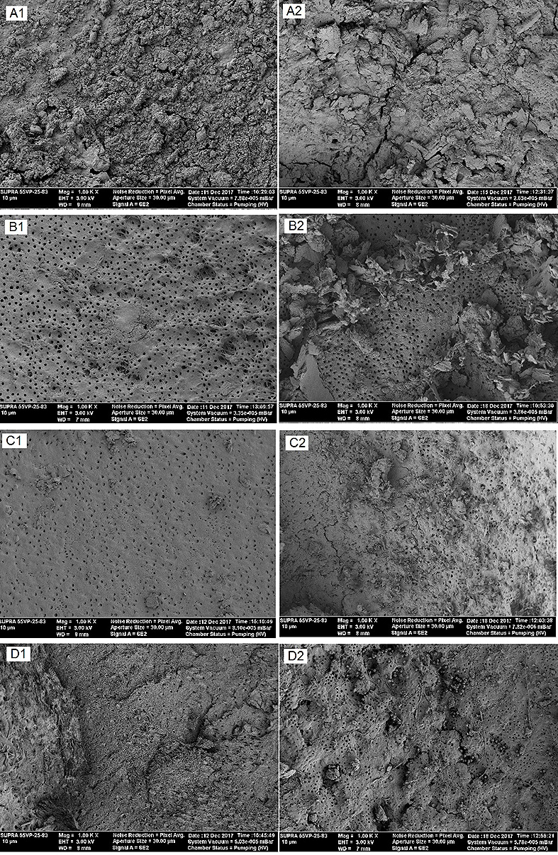 Figura 6. Fotografías con microscopía electrónica de barrido del tercio apical de dentina radicular humana (1000 x). A: Agua destilada. B: EDTA 17%. C: Ácido acético 5%. D: Ácido maleico 5%. 1: sin ultrasonido. 2: con ultrasonido.