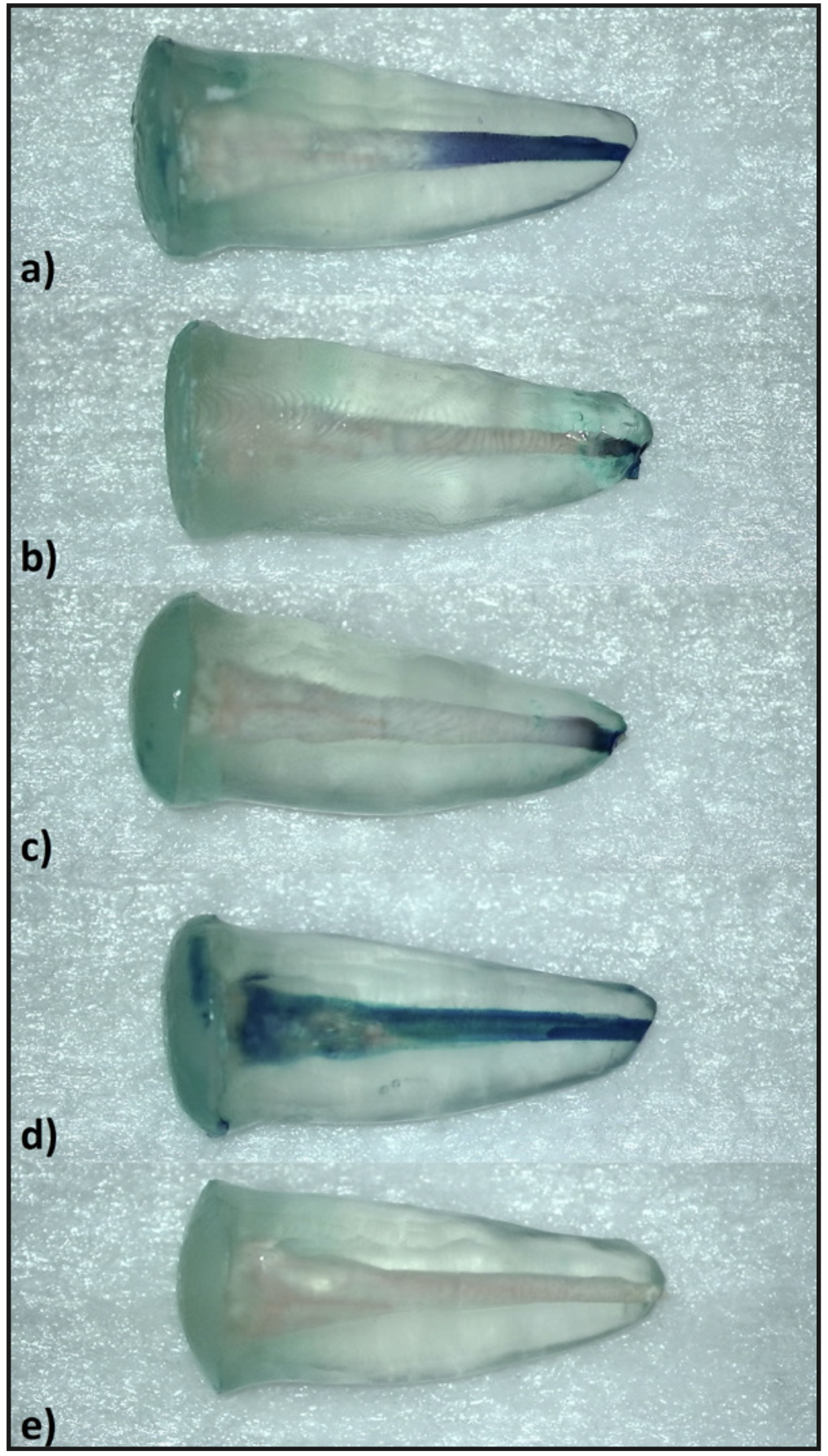 Figura 1. Muestras representativas para cada grupo de estudio. a) AH Plus BC Sealer®, b) BioRoot Flow®, c) TotalFill BC Sealer®, d) Control positivo y e) Control negativo.