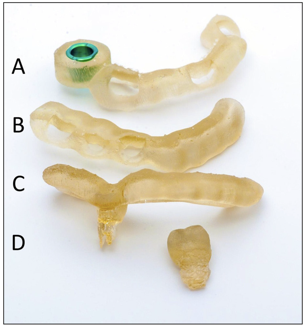 Figura 4. Impresiones 3D: (A) Guía para fresado de lecho receptor / (B) Guía para ferulización de diente donante / (C) Guía para comprobación de CARP en lecho receptor / (D) CARP.