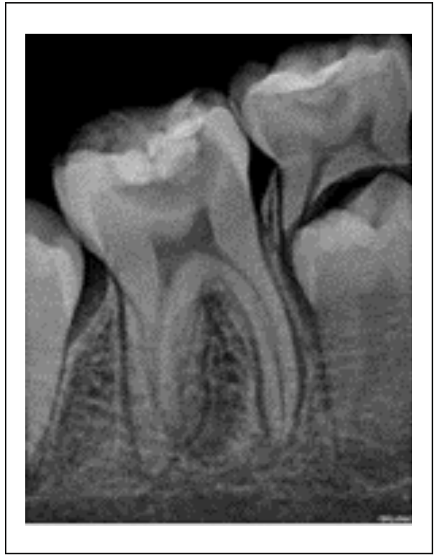 Figura 1. Rx de diagnóstico