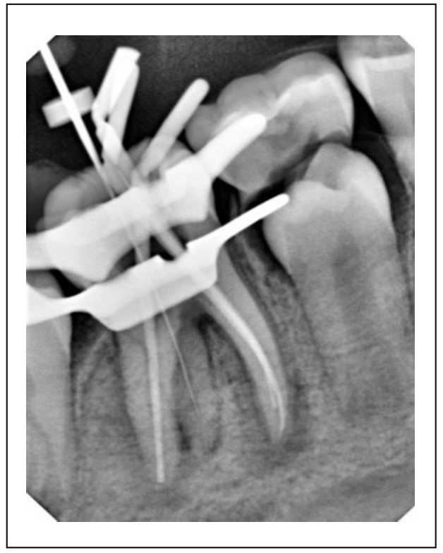Figura 6. Conductometría