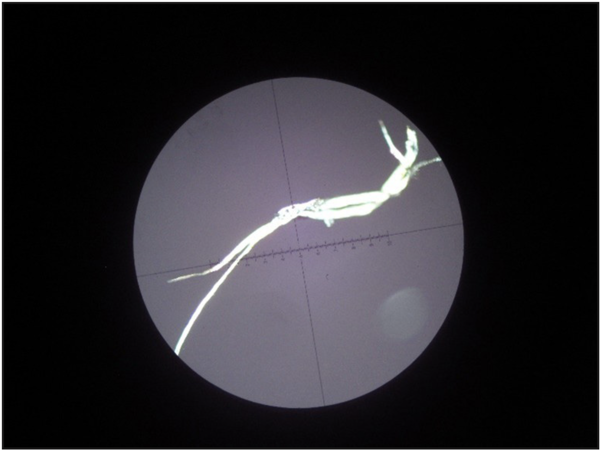 Figura 4. Fotografía del microscopio de luz polarizada (Carl Zeiss) en 5X, donde se observa desprendimiento de fibra de papel de un cono marca protaper universal.